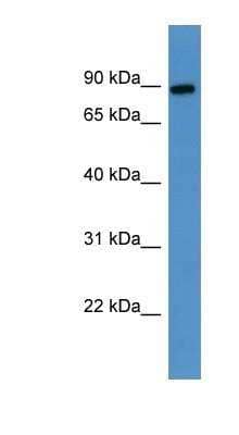 Western Blot: Lysyl Oxidase Homolog 3/LOXL3 Antibody [NBP1-79803] - Human Placenta lysate, concentration 0.2-1 ug/ml.