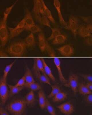 Immunocytochemistry/Immunofluorescence: Lysyl tRNA synthetase Antibody (2V2B6) [NBP3-16670] - Immunofluorescence analysis of C6 cells using Lysyl tRNA synthetase Rabbit mAb (NBP3-16670) at dilution of 1:100 (40x lens). Blue: DAPI for nuclear staining.