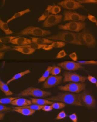 Immunocytochemistry/Immunofluorescence: Lysyl tRNA synthetase Antibody (2V2B6) [NBP3-16670] - Immunofluorescence analysis of NIH-3T3 cells using Lysyl tRNA synthetase Rabbit mAb (NBP3-16670) at dilution of 1:100 (40x lens). Blue: DAPI for nuclear staining.