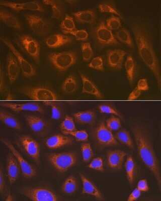 Immunocytochemistry/Immunofluorescence: Lysyl tRNA synthetase Antibody (2V2B6) [NBP3-16670] - Immunofluorescence analysis of U-2 OS cells using Lysyl tRNA synthetase Rabbit mAb (NBP3-16670) at dilution of 1:100 (40x lens). Blue: DAPI for nuclear staining.