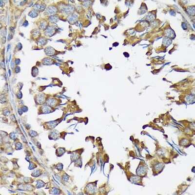 Immunohistochemistry-Paraffin: Lysyl tRNA synthetase Antibody (2V2B6) [NBP3-16670] - Immunohistochemistry of paraffin-embedded rat testis using Lysyl tRNA synthetase Rabbit mAb (NBP3-16670) at dilution of 1:100 (40x lens).Perform microwave antigen retrieval with 10 mM Tris/EDTA buffer pH 9.0 before commencing with IHC staining protocol.