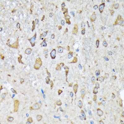 Immunohistochemistry-Paraffin: Lysyl tRNA synthetase Antibody (2V2B6) [NBP3-16670] - Immunohistochemistry of paraffin-embedded mouse spinal cord using Lysyl tRNA synthetase Rabbit mAb (NBP3-16670) at dilution of 1:100 (40x lens).Perform microwave antigen retrieval with 10 mM Tris/EDTA buffer pH 9.0 before commencing with IHC staining protocol.