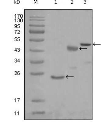 Western Blot: Lysyl tRNA synthetase Antibody (8G12C1) [NBP1-47417] - Analysis using KARS mouse mAb against truncated Trx-KARS recombinant protein (1), truncated MBP-KARS (aa90-174) and full length KARS (aa1-188) transfected CHO-K1 cell lysate (3).