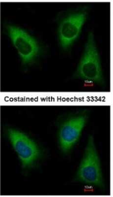 Immunocytochemistry/Immunofluorescence: Lysyl tRNA synthetase Antibody [NBP1-32063] - Paraformaldehyde-fixed HeLa, using antibody at 1:500 dilution.