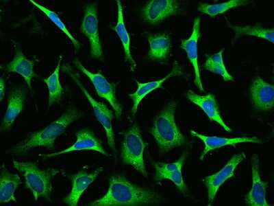 Immunocytochemistry/Immunofluorescence: Lysyl tRNA synthetase Antibody [NBP2-99362] - Immunofluorescence staining of Lysyl tRNA synthetase in HeLa cells. Cells were fixed with 4% PFA, permeabilzed with 0.1% Triton X-100 in PBS, blocked with 10% serum, and incubated with rabbit anti-Human Lysyl tRNA synthetase polyclonal antibody (dilution ratio 1:1000) at 4C overnight. Then cells were stained with the Alexa Fluor(R)488-conjugated Goat Anti-rabbit IgG Secondary antibody (green) and counterstained with DAPI (blue).Positive staining was localized to cytoplasm.