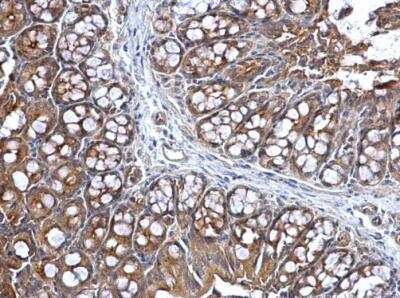 Immunohistochemistry-Paraffin: Lysyl tRNA synthetase Antibody [NBP1-32063] - Paraffin-embedded mouse colon. Lysyl-tRNA synthetase antibody dilution: 1:50