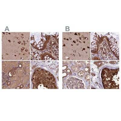 Immunohistochemistry-Paraffin Lysyl tRNA synthetase Antibody - BSA Free