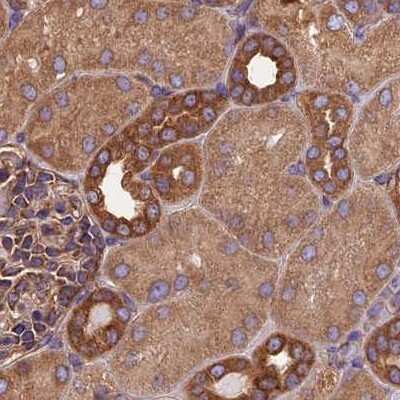 Immunohistochemistry-Paraffin: Lysyl tRNA synthetase Antibody [NBP1-87705] - Staining of human kidney.