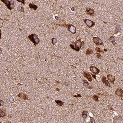 Immunohistochemistry-Paraffin: Lysyl tRNA synthetase Antibody [NBP1-87705] - Staining of human cerebral cortex.