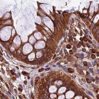 Immunohistochemistry-Paraffin: Lysyl tRNA synthetase Antibody [NBP1-87705] - Staining of human colon.