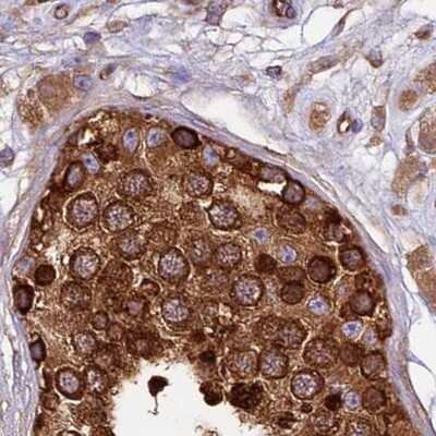 Immunohistochemistry-Paraffin: Lysyl tRNA synthetase Antibody [NBP1-87705] - Staining of human testis.