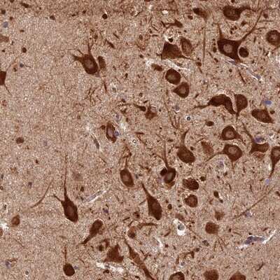 Immunohistochemistry-Paraffin: Lysyl tRNA synthetase Antibody [NBP1-87706] - Staining of human hippocampus shows strong cytoplasmic positivity in neuronal cells.