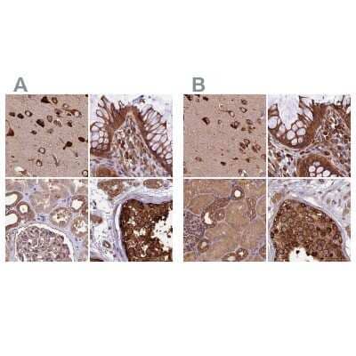 Immunohistochemistry-Paraffin: Lysyl tRNA synthetase Antibody [NBP1-87706] - Staining of human cerebral cortex, colon, kidney and testis using Anti-KARS antibody NBP1-87706 (A) shows similar protein distribution across tissues to independent antibody NBP1-87705 (B).