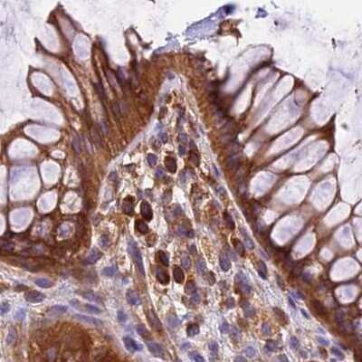 Immunohistochemistry-Paraffin: Lysyl tRNA synthetase Antibody [NBP1-87706] - Staining of human colon.