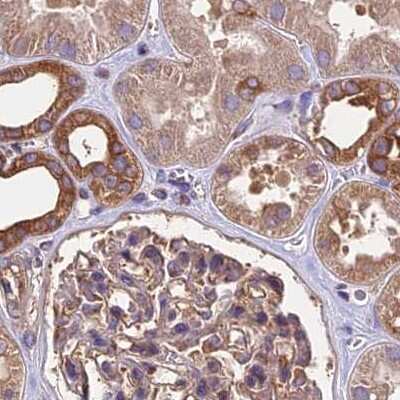 Immunohistochemistry-Paraffin: Lysyl tRNA synthetase Antibody [NBP1-87706] - Staining of human kidney.