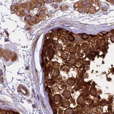 Immunohistochemistry-Paraffin: Lysyl tRNA synthetase Antibody [NBP1-87706] - Staining of human testis.