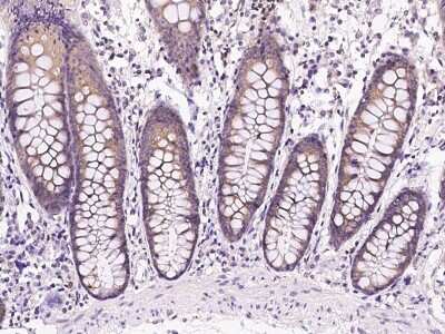 Immunohistochemistry-Paraffin: Lysyl tRNA synthetase Antibody [NBP2-99362] - Immunochemical staining of human Lysyl tRNA synthetase in human colon with rabbit polyclonal antibody at 1:1000 dilution, formalin-fixed paraffin embedded sections.