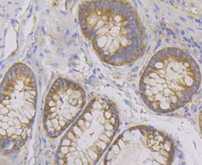 Immunohistochemistry-Paraffin: Lysyl tRNA synthetase Antibody (JE40-55) [NBP2-75560] - Analysis of paraffin-embedded human colon tissue using anti-Lysyl tRNA synthetase antibody. Counter stained with hematoxylin.