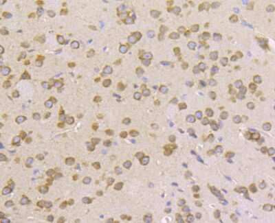 Immunohistochemistry-Paraffin: Lysyl tRNA synthetase Antibody (JE40-55) [NBP2-75560] - Analysis of paraffin-embedded mouse brain tissue using anti-Lysyl tRNA synthetase antibody. Counter stained with hematoxylin.