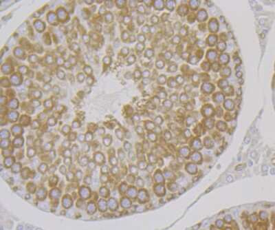 Immunohistochemistry-Paraffin: Lysyl tRNA synthetase Antibody (JE40-55) [NBP2-75560] - Analysis of paraffin-embedded rat testis tissue using anti-Lysyl tRNA synthetase antibody. Counter stained with hematoxylin.