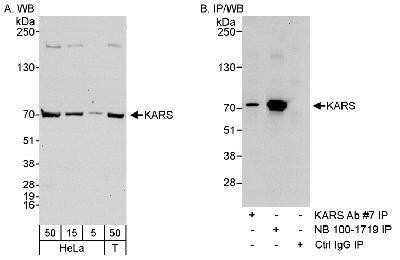 Western Blot: Lysyl tRNA synthetase Antibody [NB100-1719] - Samples: Whole cell lysate from HeLa (5, 15 and 50 mcg for WB; 1 mg for IP, 20% of IP loaded) and 293T (T; 50 mcg) cells.  Affinity purified rabbit anti-Lysyl tRNA synthetase antibody NB100-1719 used for WB at 0.04 mcg/ml (A) and 1 mcg/ml (B) and used for IP at 3 mcg/mg lysate (B).