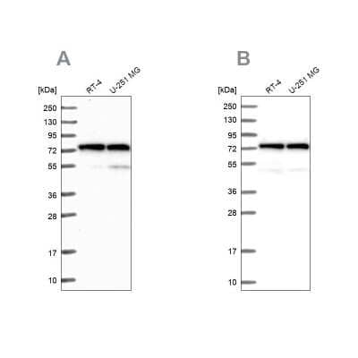 <b>Independent Antibodies Validation. </b>Western Blot: Lysyl tRNA synthetase Antibody [NBP1-87705] - Analysis using Anti-KARS antibody NBP1-87705 (A) shows similar pattern to independent antibody NBP1-87706 (B).