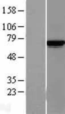 Western Blot: Lysyl tRNA synthetase Overexpression Lysate (Adult Normal) [NBL1-12123] Left-Empty vector transfected control cell lysate (HEK293 cell lysate); Right -Over-expression Lysate for Lysyl tRNA synthetase.