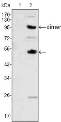 Western Blot: M-CSF Antibody (2D10) [NBP1-47472] - Analysis using CSF1 mouse mAb against human recombinant CSF2 (1) and CSF1 (2).