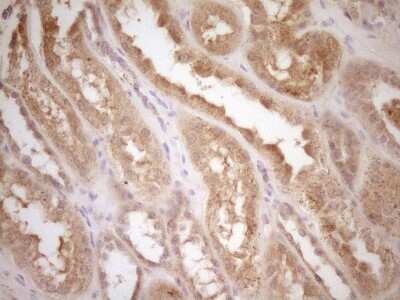 Immunohistochemistry: M-CSF Antibody (8E1) [NBP2-46363] - Analysis of Human Kidney tissue. (Heat-induced epitope retrieval by 1 mM EDTA in 10mM Tris, pH8.5, 120C for 3min)