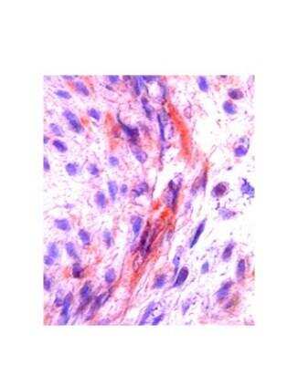 Immunohistochemistry-Paraffin: M-CSF Antibody [NBP1-59425] - Human Placenta Tissue, 10 ug/ml