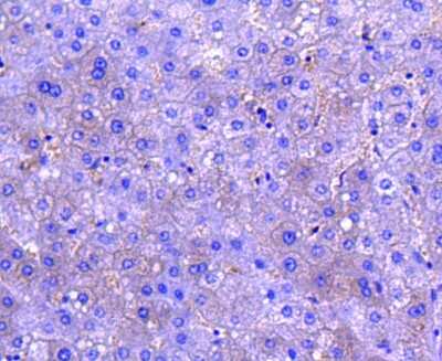 Immunohistochemistry-Paraffin: M-CSF Antibody (SU0413) [NBP2-67490] - Analysis of paraffin-embedded human liver tissue using anti-MCSF antibody. Counter stained with hematoxylin.