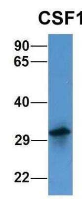 Western Blot: M-CSF Antibody [NBP1-59425] - Expressed in Human 721_B cells.