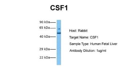 Western Blot: M-CSF Antibody [NBP1-59425] - Sample Tissue: Human Fetal Liver Antibody Dilution: 1.0 ug/ml