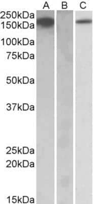 Western Blot: M-CSF R Antibody [NBP1-52071] -  HEK293 lysate (10ug protein in RIPA buffer) overexpressing Human CSF1R with C-terminal MYC tag probed with EB10258 (1ug/ml) in Lane A and probed with anti-MYC Tag (1/1000) in lane C. Mock-transfected HEK293 probed with EB10258 (1mg/ml) in Lane B. Primary incubations were for 1 hour. Detected by chemiluminescence.