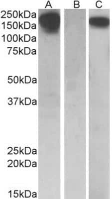 Western Blot: M-CSF R/CD115 Antibody [NBP1-52070] - HEK293 lysate (10ug protein in RIPA buffer) overexpressing Human CSF1R with C-terminal MYC tag probed with EB10257 (0.5ug/ml) in Lane A and probed with anti-MYC Tag (1/1000) in lane C. Mock-transfected HEK293 probed with EB10257 (1mg/ml) in Lane B. Primary incubations were for 1 hour. Detected by chemiluminescence.