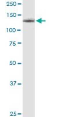 Western Blot: M-CSFR/CD115 Antibody (1G4) [H00001436-M01] - CSF1R monoclonal antibody (M01), clone 1G4. Analysis of CSF1R expression in human colon.