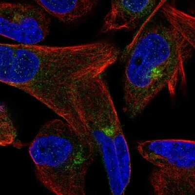 <b>Orthogonal Strategies Validation. </b>Immunocytochemistry/Immunofluorescence: M-Cadherin/Cadherin-15 Antibody [NBP1-88101] - Staining of human cell line RH-30 shows localization to cytosol & the Golgi apparatus. Antibody staining is shown in green.