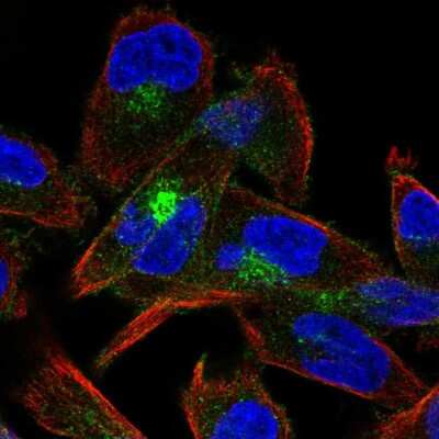 Immunocytochemistry/Immunofluorescence: M-Cadherin/Cadherin-15 Antibody [NBP2-57991] - Staining of human cell line RH-30 shows localization to cytosol & the Golgi apparatus.