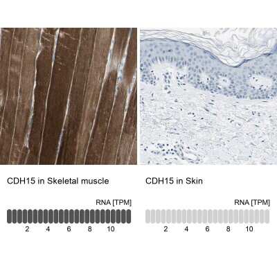 Immunohistochemistry-Paraffin: M-Cadherin/Cadherin-15 Antibody [NBP1-88101] - Analysis in human skeletal muscle and skin tissues. Corresponding CDH15 RNA-seq data are presented for the same tissues.