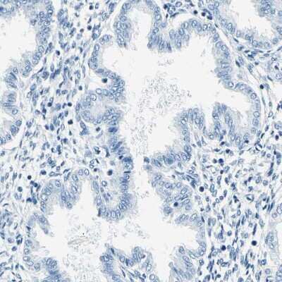 Immunohistochemistry-Paraffin: M-Cadherin/Cadherin-15 Antibody [NBP1-88101] - Staining of human endometrium shows no positivity in glandular cells as expected.