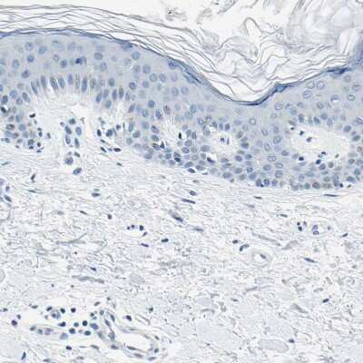 Immunohistochemistry-Paraffin: M-Cadherin/Cadherin-15 Antibody [NBP1-88101] - Staining of human skin shows no positivity in squamous epithelial cells as expected.