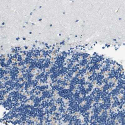 Immunohistochemistry-Paraffin: M-Cadherin/Cadherin-15 Antibody [NBP1-88101] - Staining of human cerebellum shows weak cytoplasmic positivity in cells in granular layer.