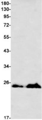 Western Blot: M-Ras/R-Ras3 Antibody (S07-2A5) [NBP3-19680] - Western blot detection of M-Ras/R-Ras3 in Hela (Lane 1), Rat Brain (Lane 2) lysates using NBP3-19680 (1:1000 diluted). Predicted band size: 24kDa. Observed band size: 24kDa.
