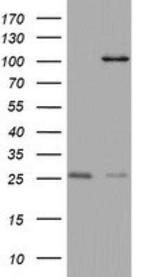Western Blot: MAATS1 Antibody (OTI6G1) - Azide and BSA Free [NBP2-72309] - Analysis of HEK293T cells were transfected with the pCMV6-ENTRY control (Left lane) or pCMV6-ENTRY C3orf15.