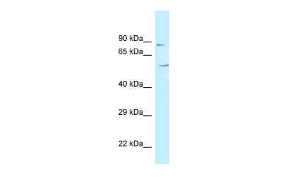 Western Blot: MAATS1 Antibody [NBP2-86593] - WB Suggested Anti-C3orf15 Antibody. Titration: 1.0 ug/ml. Positive Control: Fetal Heart