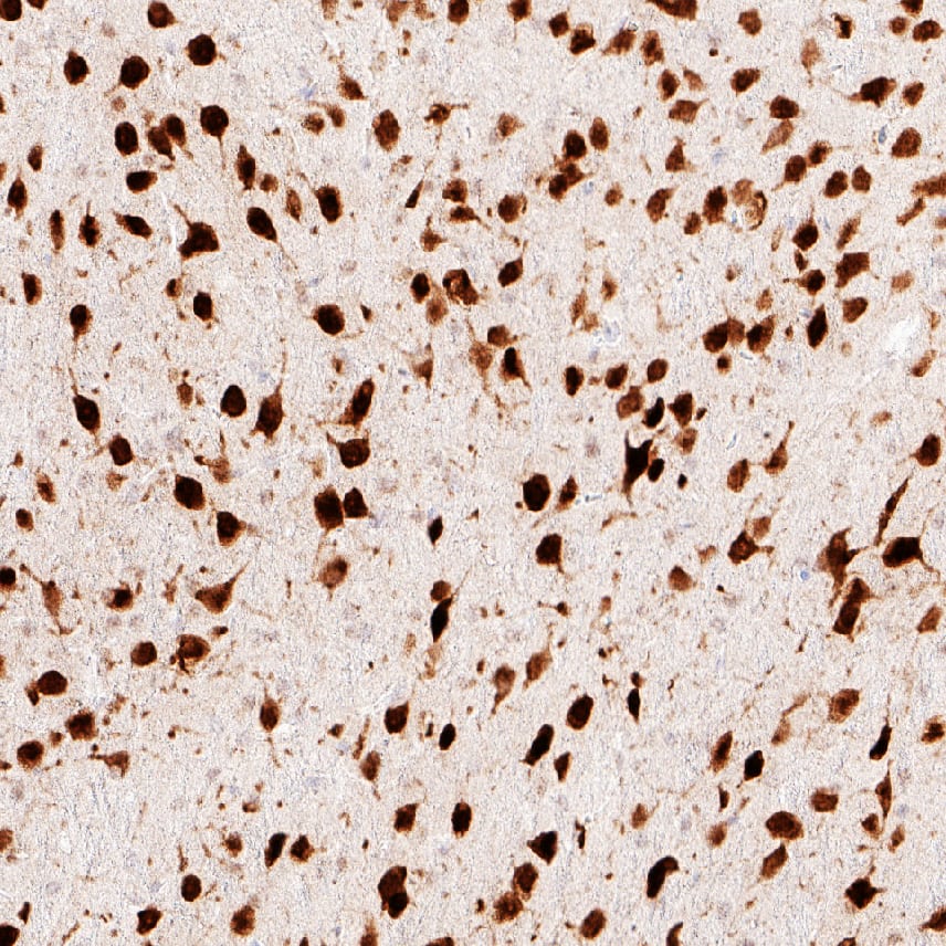 RBFOX3/NeuN was detected in immersion fixed paraffin-embedded sections of mouse hippocampus using Rabbit Anti-Human RBFOX3/NeuN Monoclonal Antibody (Catalog # MAB11690) at 1 µg/ml overnight at 4 &deg;C. Before incubation with the primary antibody, tissue was subjected to heat-induced epitope retrieval using VisUCyte Antigen Retrieval Reagent-Basic (Catalog # VCTS021). Tissue was stained using the HRP-conjugated Anti-Rabbit IgG Secondary Antibody (HAF008) and counterstained with hematoxylin (blue). Specific staining was localized to specific staining localized to the nucleus and cytoplasm. View our protocol for Chromogenic IHC Staining of Paraffin-embedded Tissue Sections.