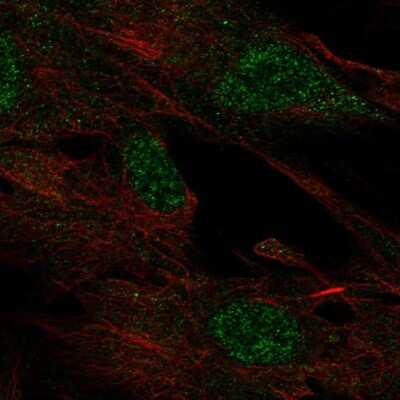 Immunocytochemistry/Immunofluorescence: MAB21L2 Antibody [NBP2-58093] - Staining of human cell line BJ shows localization to nucleoplasm. Antibody staining is shown in green. 