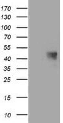 Western Blot: MAB21L3 Antibody (OTI1F6) - Azide and BSA Free [NBP2-72563] - HEK293T cells were transfected with the pCMV6-ENTRY control (Left lane) or pCMV6-ENTRY MAB21L3 (Right lane) cDNA for 48 hrs and lysed. Equivalent amounts of cell lysates (5 ug per lane) were separated by SDS-PAGE and immunoblotted with anti-MAB21L3.