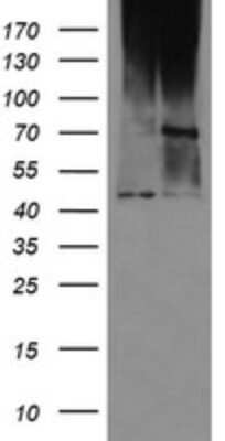 Western Blot: MAB21L3 Antibody (OTI2A3) - Azide and BSA Free [NBP2-72562] - Analysis of HEK293T cells were transfected with the pCMV6-ENTRY control (Left lane) or pCMV6-ENTRY MAB21L3.