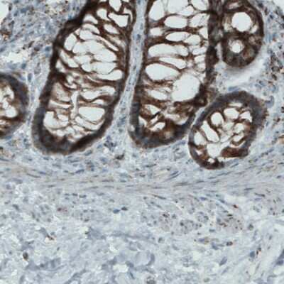 Immunohistochemistry-Paraffin: MACC1 Antibody (CL0856) [NBP2-52955] - Staining of human colon shows strong cytoplasmic positivity in glandular cells.